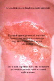 <p> рис.5а </p> <p> рис.5а </p>